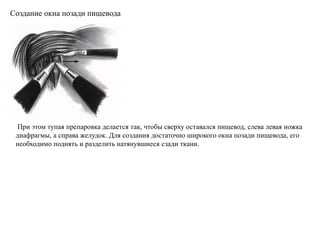 При этом тупая препаровка делается так, чтобы сверху оставался пищевод, слева левая ножка
диафрагмы, а справа желудок. Для создания достаточно широкого окна позади пищевода, его
необходимо поднять и разделить натянувшиеся сзади ткани.
Создание окна позади пищевода
 