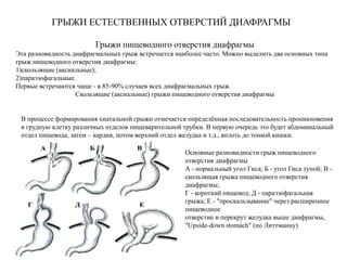 ГРЫЖИ ЕСТЕСТВЕННЫХ ОТВЕРСТИЙ ДИАФРАГМЫ
Грыжи пищеводного отверстия диафрагмы
Эта разновидность диафрагмальных грыж встречается наиболее часто. Можно выделить два основных типа
грыж пищеводного отверстия диафрагмы:
1)скользящие (аксиальные);
2)параэзофагальные.
Первые встречаются чаще - в 85-90% случаев всех диафрагмальных грыж.
Скользящие (аксиальные) грыжи пищеводного отверстия диафрагмы
В процессе формирования хиатальной грыжи отмечается определённая последовательность проникновения
в грудную клетку различных отделов пищеварительной трубки. В первую очередь это будет абдоминальный
отдел пищевода, затем – кардия, потом верхний отдел желудка и т.д., вплоть до тонкой кишки.
Основные разновидности грыж пищеводного
отверстия диафрагмы
А - нормальный угол Гиса; Б - угол Гиса тупой; В -
скользящая грыжа пищеводного отверстия
диафрагмы;
Г - короткий пищевод; Д - параэзофагальная
грыжа; Е - "проскальзывание" через расширенное
пищеводное
отверстие и перекрут желудка выше диафрагмы,
"Upside-down stomach" (по Литтманну)
 