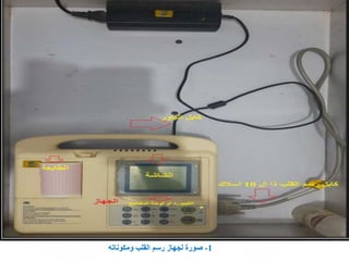 1
-
‫ومكوناته‬ ‫القلب‬ ‫رسم‬ ‫لجهاز‬ ‫صورة‬
 
