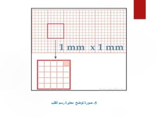 5
-
‫القلب‬ ‫رسم‬ ‫معايرة‬ ‫توضح‬ ‫صورة‬
 