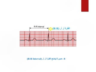 8
-
‫أر‬ ‫أر‬ ‫الفترة‬ ‫توضح‬ ‫صورة‬
(
R-R Interval
)
 