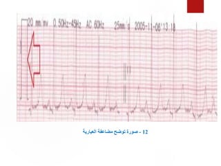 12
-
‫العيارية‬ ‫مضاعفة‬ ‫توضح‬ ‫صورة‬
 