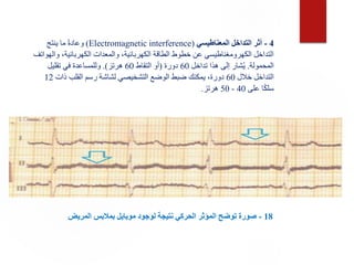 18
-
‫المريض‬ ‫بمالبس‬ ‫موبايل‬ ‫لوجود‬ ‫نتيجة‬ ‫الحركي‬ ‫المؤثر‬ ‫توضح‬ ‫صورة‬
4
-
‫المعناطيسي‬ ‫التداخل‬ ‫أثر‬
(
Electromagnetic interference
)
‫ينتج‬ ‫ما‬ ً‫ة‬‫وعاد‬
‫و‬ ،‫الكهربائية‬ ‫والمعدات‬ ،‫الكهربائية‬ ‫الطاقة‬ ‫خطوط‬ ‫عن‬ ‫الكهرومغناطيسي‬ ‫التداخل‬
‫الهواتف‬
‫المحمولة‬
.
‫تداخل‬ ‫هذا‬ ‫إلى‬ ‫شار‬ُ‫ي‬
60
‫دورة‬
(
‫التقاط‬ ‫أو‬
60
‫هرتز‬
.)
‫تقليل‬ ‫في‬ ‫وللمساعدة‬
‫خالل‬ ‫التداخل‬
60
‫ذات‬ ‫القلب‬ ‫رسم‬ ‫لشاشة‬ ‫التشخيصي‬ ‫الوضع‬ ‫ضبط‬ ‫يمكنك‬ ،‫دورة‬
12
‫على‬ ‫ا‬ً‫ك‬‫سل‬
40
-
50
‫هرتز‬
.
 