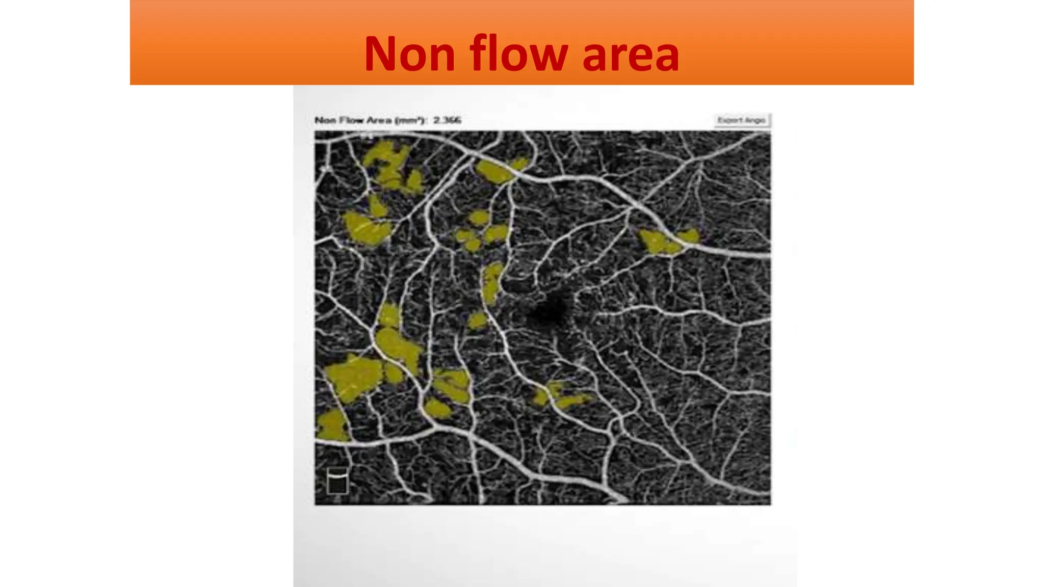 Non flow area