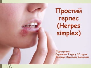Простий
герпес
(Herpes
simplex)
Підготувала:
Студентка 4 курсу 12 групи
Волощук Христина Василівна
 