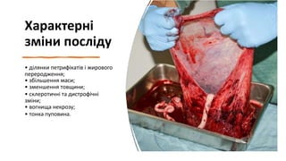 Характерні
зміни посліду
• ділянки петрифікатів і жирового
переродження;
• збільшення маси;
• зменшення товщини;
• склеротичні та дистрофічні
зміни;
• вогнища некрозу;
• тонка пуповина.
 