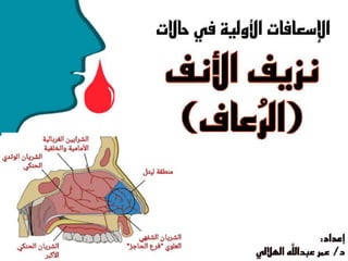 الإسعافات الأولية في حالة نزيف الأنف (الرعاف).ppt