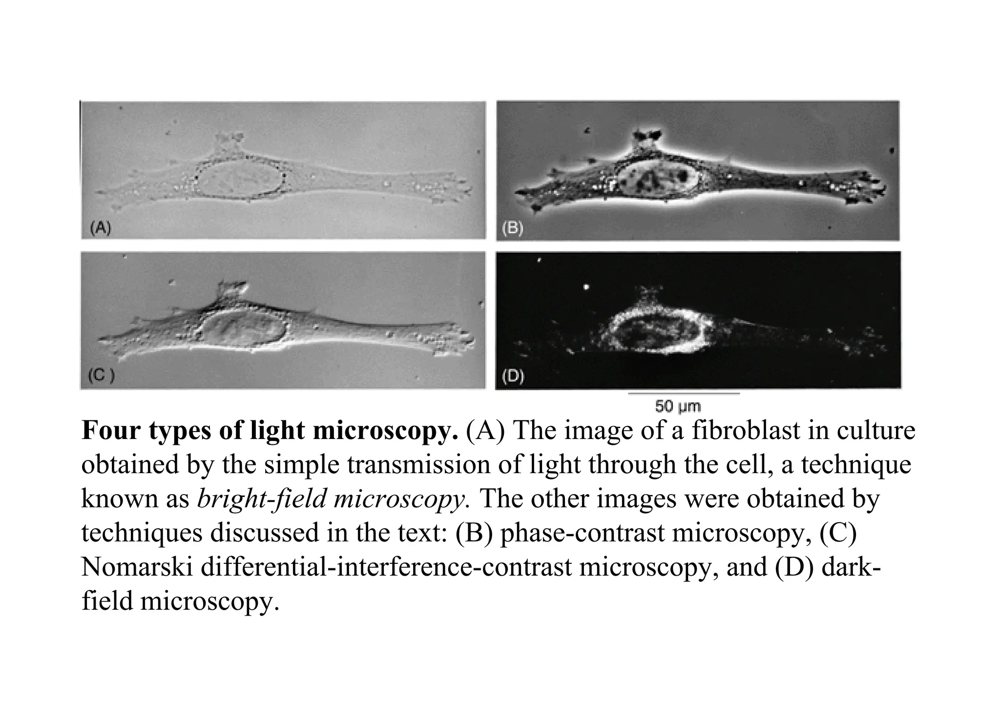 Four types of light microscopy. (A) The image of a fibroblast in culture
obtained by the simple transmission of light through the cell, a technique
known as bright-field microscopy. The other images were obtained by
techniques discussed in the text: (B) phase-contrast microscopy, (C)
Nomarski differential-interference-contrast microscopy, and (D) dark-
field microscopy.
 