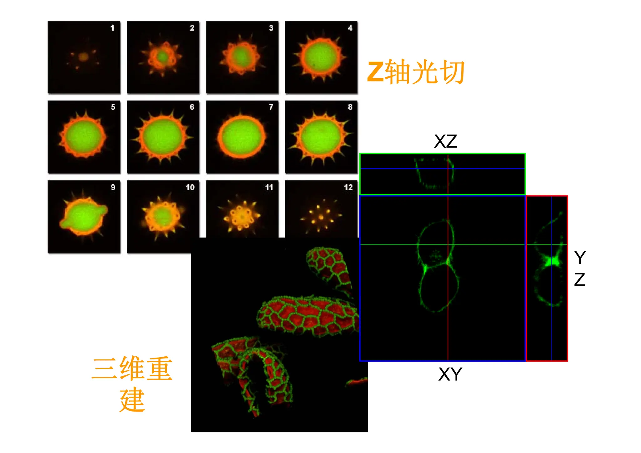 Y
Z
XZ
XY
Z轴光切
三维重
建
 