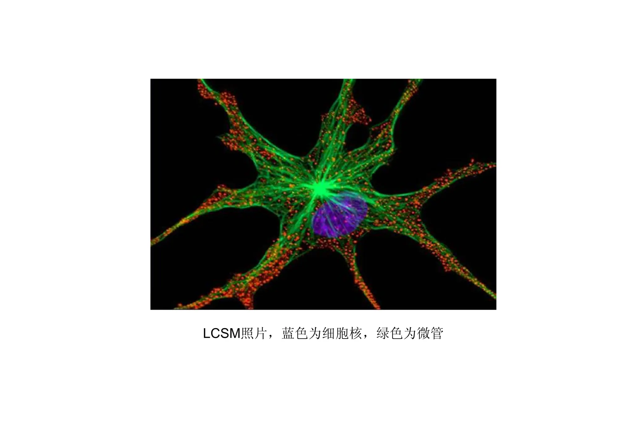 LCSM照片，蓝色为细胞核，绿色为微管
 