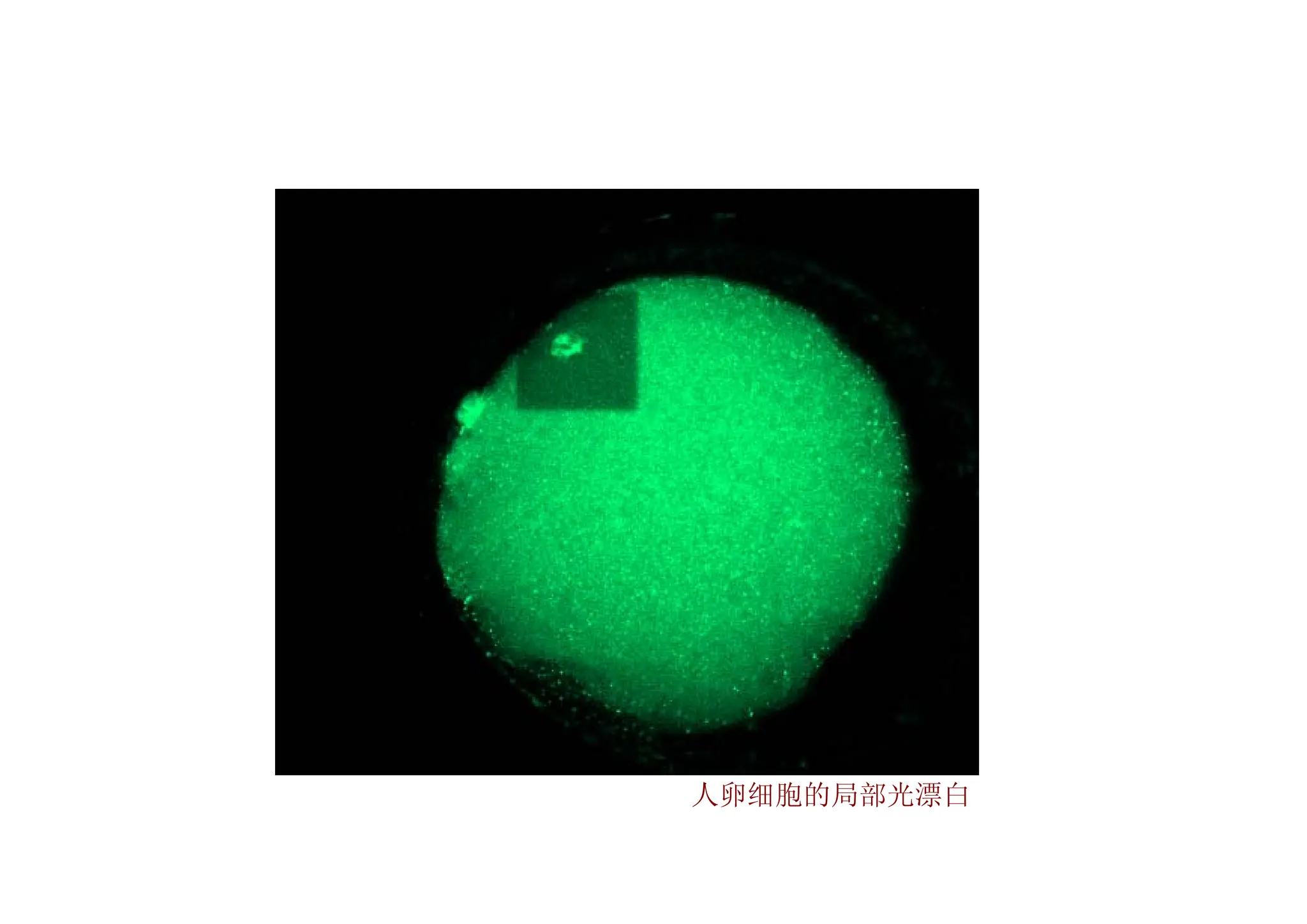 人卵细胞的局部光漂白
 