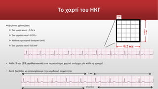 Το χαρτί του ΗΚΓ
•Οριζόντια: χρόνος (sec)
 Ένα μικρό κουτί - 0.04 s
 Ένα μεγάλο κουτί - 0.20 s
 Κάθετα: ηλεκτρικό δυναμικό (mV)
 Ένα μεγάλο κουτί - 0.5 mV
▪ Κάθε 3 sec (15 μεγάλα κουτιά) στα περισσότερα χαρτιά υπάρχει μία κάθετη γραμμή
• Αυτό βοηθάει να υπολογίσουμε την καρδιακή συχνότητα
3 sec
15 κουτάκια
 