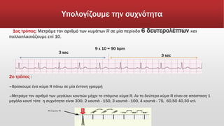 Υπολογίζουμε την συχνότητα
1ος τρόπος: Μετράμε τον αριθμό των κυμάτων R σε μία περίοδο 6 δευτερολέπτων και
πολλαπλασιάζουμε επί 10.
2o τρόπος :
–Βρίσκουμε ένα κύμα R πάνω σε μία έντονη γραμμή
–Μετράμε τον αριθμό των μεγάλων κουτιών μέχρι το επόμενο κύμα R. Αν το δεύτερο κύμα R είναι σε απόσταση 1
μεγάλο κουτί τότε η συχνότητα είναι 300, 2 κουτιά - 150, 3 κουτιά - 100, 4 κουτιά - 75, 60,50 40,30 κτλ
3 sec
9 x 10 = 90 bpm
 