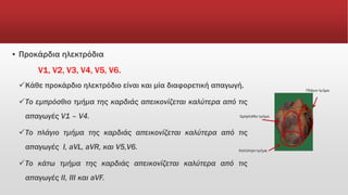 ▪ Προκάρδια ηλεκτρόδια
V1, V2, V3, V4, V5, V6.
Κάθε προκάρδιο ηλεκτρόδιο είναι και μία διαφορετική απαγωγή.
Το εμπρόσθιο τμήμα της καρδιάς απεικονίζεται καλύτερα από τις
απαγωγές V1 – V4.
Το πλάγιο τμήμα της καρδιάς απεικονίζεται καλύτερα από τις
απαγωγές I, aVL, aVR, και V5,V6.
Το κάτω τμήμα της καρδιάς απεικονίζεται καλύτερα από τις
απαγωγές II, III και aVF.
 