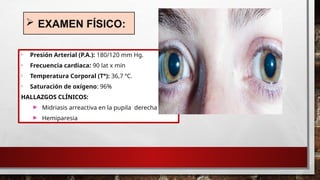  EXAMEN FÍSICO:
• Presión Arterial (P.A.): 180/120 mm Hg.
• Frecuencia cardiaca: 90 lat x min
• Temperatura Corporal (T°): 36,7 ºC.
• Saturación de oxígeno: 96%
HALLAZGOS CLÍNICOS:
 Midriasis arreactiva en la pupila derecha
 Hemiparesia
 