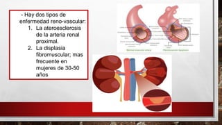 - Hay dos tipos de
enfermedad reno-vascular:
1. La ateroesclerosis
de la arteria renal
proximal.
2. La displasia
fibromuscular; mas
frecuente en
mujeres de 30-50
años
 