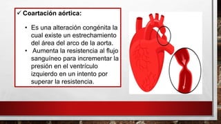 ✓ Coartación aórtica:
• Es una alteración congénita la
cual existe un estrechamiento
del área del arco de la aorta.
• Aumenta la resistencia al flujo
sanguíneo para incrementar la
presión en el ventrículo
izquierdo en un intento por
superar la resistencia.
 