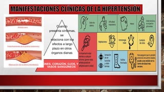 Cuando
presenta síntomas,
se
relaciona con los
efectos a largo
plazo en otros
órganos dianas
RIÑONES, CORAZÓN, OJOS, Y LOS
VASOS SANGUÍNEOS
 