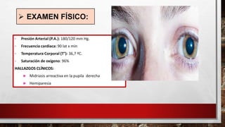➢ EXAMEN FÍSICO:
• Presión Arterial (P.A.): 180/120 mm Hg.
• Frecuencia cardiaca: 90 lat x min
• Temperatura Corporal (T°): 36,7 ºC.
• Saturación de oxígeno: 96%
HALLAZGOS CLÍNICOS:
 Midriasis arreactiva en la pupila derecha
 Hemiparesia
 