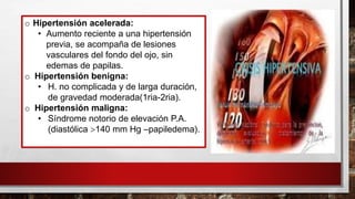 o Hipertensión acelerada:
• Aumento reciente a una hipertensión
previa, se acompaña de lesiones
vasculares del fondo del ojo, sin
edemas de papilas.
o Hipertensión benigna:
• H. no complicada y de larga duración,
de gravedad moderada(1ria-2ria).
o Hipertensión maligna:
• Síndrome notorio de elevación P.A.
(diastólica 140 mm Hg –papiledema).
 