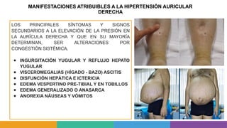 MANIFESTACIONES ATRIBUIBLES A LA HIPERTENSIÓN AURICULAR
DERECHA
LOS PRINCIPALES SÍNTOMAS Y SIGNOS
SECUNDARIOS A LA ELEVACIÓN DE LA PRESIÓN EN
LA AURÍCULA DERECHA Y QUE EN SU MAYORÍA
DETERMINAN, SER ALTERACIONES POR
CONGESTIÓN SISTÉMICA.
● INGURGITACIÓN YUGULAR Y REFLUJO HEPATO
YUGULAR
● VISCEROMEGALIAS (HÍGADO - BAZO) ASCITIS
● DISFUNCIÓN HEPÁTICA E ICTERICIA
● EDEMA VESPERTINO PRE-TIBIAL Y EN TOBILLOS
● EDEMA GENERALIZADO O ANASARCA
● ANOREXIA NÁUSEAS Y VÓMITOS
 
