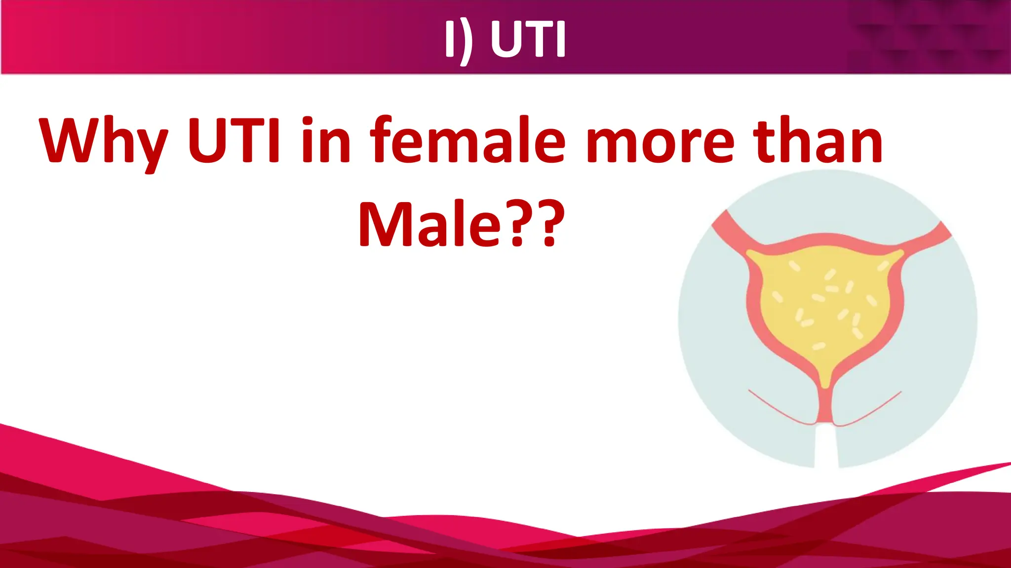 I) UTI
Why UTI in female more than
Male??
 