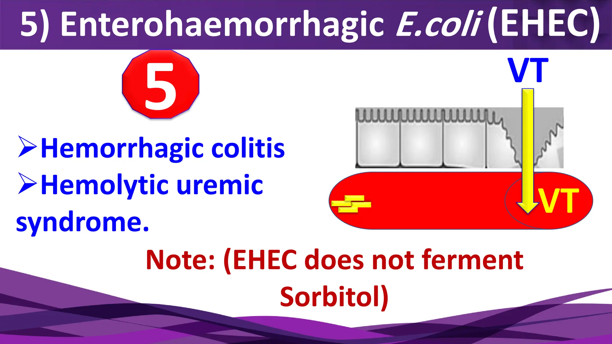 5) Enterohaemorrhagic E.coli (EHEC)
5 VT
VT
➢Hemorrhagic colitis
➢Hemolytic uremic
syndrome.
Note: (EHEC does not ferment
Sorbitol)
 