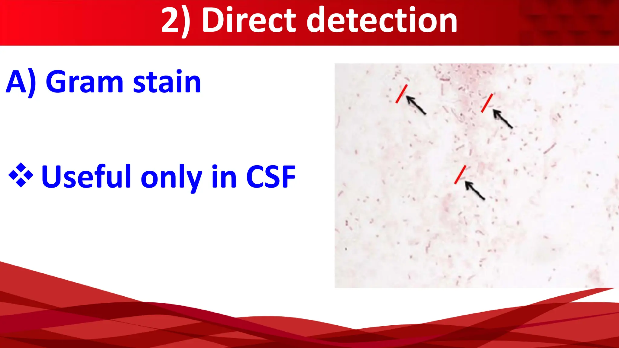 2) Direct detection
A) Gram stain
❖Useful only in CSF
 