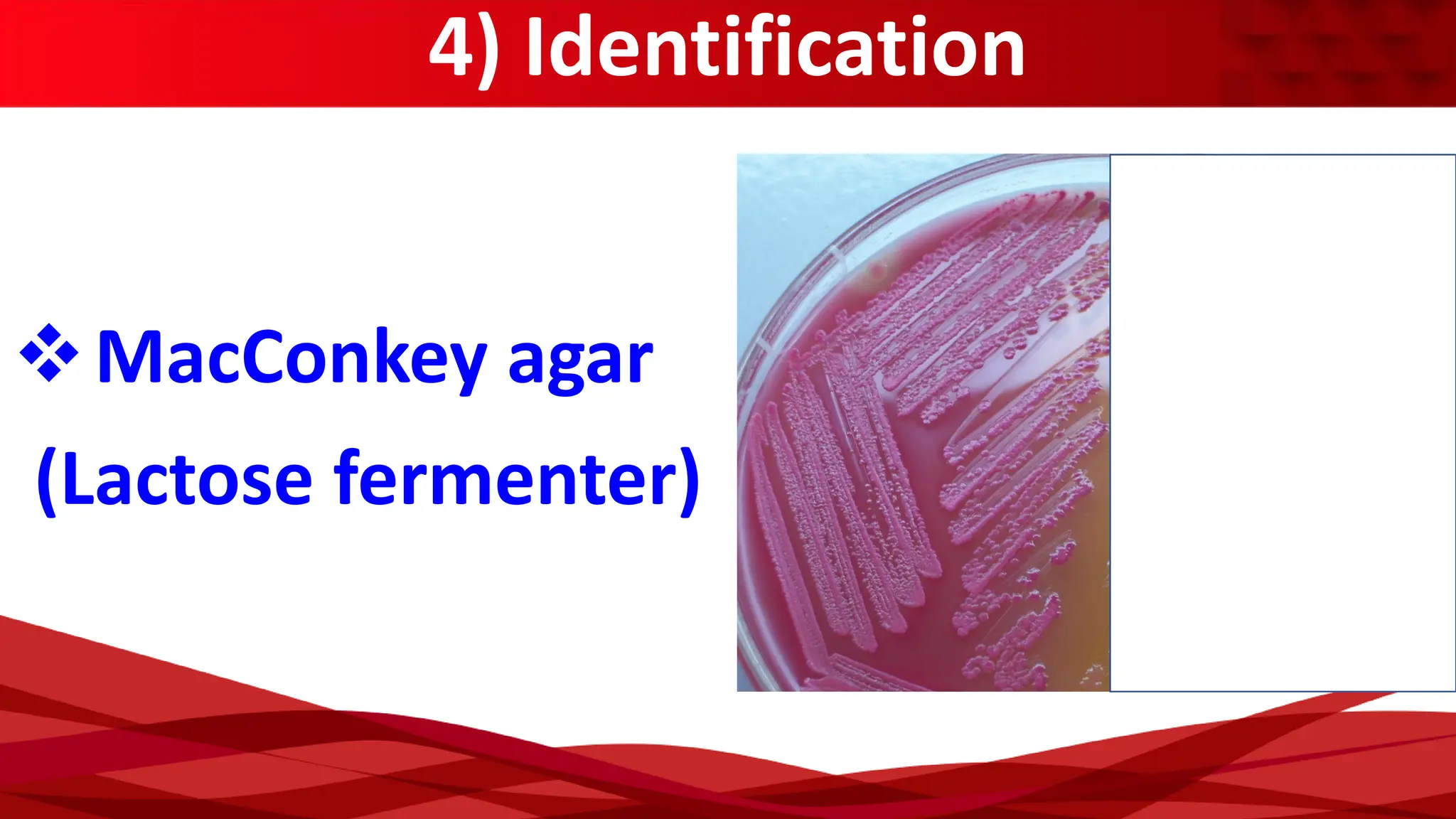 4) Identification
(Lactose fermenter)
❖MacConkey agar
 