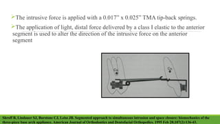 Deep bite - Classification Treatment modalities.pptx