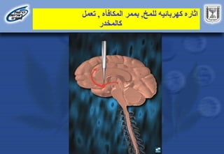 ‫للمخ‬ ‫كهربائيه‬ ‫اثاره‬
,
‫المكافأه‬ ‫بممر‬
,
‫تعمل‬
‫كالمخدر‬
 