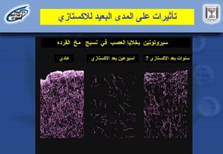 ‫لالكستازي‬ ‫البعيد‬ ‫المدى‬ ‫على‬ ‫تأثيرات‬
‫عادي‬ ‫االكستازي‬ ‫بعد‬ ‫اسبوعين‬ 7 ‫االكستازي‬ ‫بعد‬ ‫سنوات‬
‫سيروتونين‬
‫العصب‬ ‫بخاليا‬
‫نسيج‬ ‫في‬
‫القرده‬ ‫مخ‬
 