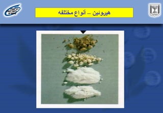 ‫وئين‬D‫ر‬‫هي‬
–
‫مختلفه‬ ‫أنواع‬
 