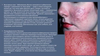 • Вульгарные угри - Заболевание обычно начинается в пубертатном
периоде с появлением на лице (реже — груди и спине) комедонов,
мелких до 5 мм папул ярко-красного цвета, иногда с пустулой на
поверхности. Высыпания оставляют пигментацию, реже — поверхностные
рубчики. На лице, волосистой части головы, груди и межлопаточной
области кожа становится жирной, блестящей, неровной, шероховатой, с
расширенными устьями волосяных фолликулов.
Располагающиеся на поверхности кожи пропионибактерии и
стафилококки продуцируют эндогенную липазу, которая расщепляет
триглицериды кожного сала до свободных жирных кислот. Последние
оказывают раздражающее действие на кожу, вызывают различные
осложнения: акне-келоид, флегмонозные угри, acne confluens, acne
conglobata, acne fulminans
• Псевдофурункулез Фингера
Это заболевание является результатом развития инфекционного процесса
в выводных протоках и клубочках эккриновых потовых желез. Происходит
поражение всего выводного протока и клубочков потовой железы. В
результате образуются многочисленные узлы повышенной плотности,
красного цвета с синевой, резко отграниченные от здоровой кожи,
имеющие склонность к увеличению в размерах (обычно достигают
величины лесного ореха). Через короткий промежуток времени
происходит размягчение узлов в центре, где кожа становится тонкой и где
скапливается гнойное содержимое. После вскрытия узлов и истечения
гноя происходит рубцевание. Располагаются абсцессы чаще на затылке,
спине, бедрах, ягодицах, т. е. на тех местах тела, которые соприкасаются с
постелью.
 