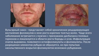 Вульгарный сикоз - представляет собой хроническое рецидивирующее
воспаление фолликулов в зоне роста коротких толстых волос. Чаще всего
заболевание встречается у мужчин с признаками дисбаланса половых
гормонов и локализуется в области роста бороды и усов. Инфильтрация
очагов выражена, появляются остиофолликулиты и фолликулиты. После
разрешения элементов рубцов не образуется, но при попытках
насильственного вскрытия фолликулитов возможно рубцевание.
 