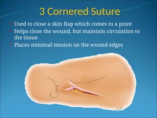 3 Cornered Suture
• Used to close a skin flap which comes to a point
• Helps close the wound, but maintain circulation to
the tissue
• Places minimal tension on the wound edges
 