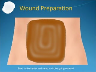 Start in the center and swab in circles going outward
 