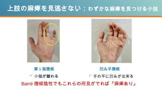 第 5 指徴候
 小指が離れる
上肢の麻痺を見逃さない：わずかな麻痺を見つける小技
 手の平に凹みが出来る
Barré 徴候陰性でもこれらの所見がでれば『麻痺あり』
凹み手徴候
 