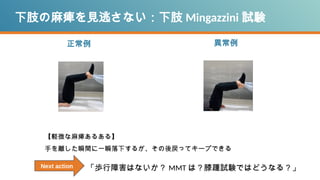 下肢の麻痺を見逃さない：下肢 Mingazzini 試験
正常例 異常例
【軽微な麻痺あるある】
手を離した瞬間に一瞬落下するが、その後戻ってキープできる
「歩行障害はないか？ MMT は？膝踵試験ではどうなる？」
Next action
 
