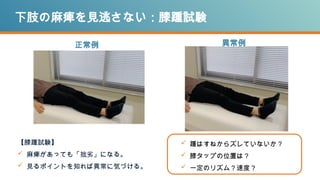 下肢の麻痺を見逃さない：膝踵試験
正常例 異常例
【膝踵試験】
 麻痺があっても「拙劣」になる。
 見るポイントを知れば異常に気づける。
 踵はすねからズレていないか？
 膝タップの位置は？
 一定のリズム？速度？
 