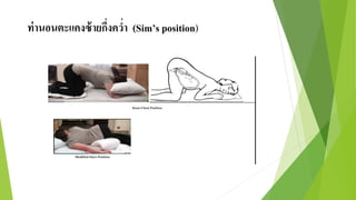 ท่านอนตะแคงซ้ายกึ่งคว่า (Sim’s position)
 