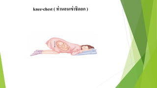 knee-chest ( ท่านอนเข่าชิดอก )
 