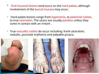 Systemic lupus erythrematous how to diagnose and how to manage | PPT