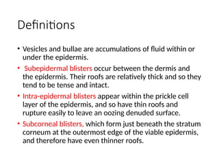 Bullous diseases Dermatology of 5th .pptx