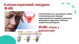 Клімактеричний синдром
30-60%
патологічний стан, що виникає у жінок
в клімактеричному періоді і
характеризується нервово-психічними,
вегетативно-судинними і обмінно-
трофічними розладами.
30-60% жінок у
клімактерії
 