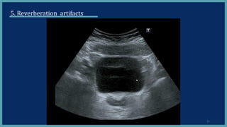 artifacts in ultrasound pdf | PDF