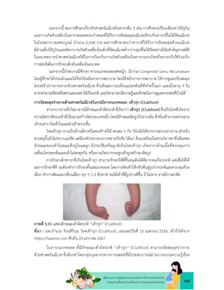 159
คูมือแนวทางการดูแลสุขภาพมารดาและทารกดวยการแพทยแผนไทย
ในระยะกอนตั้งครรภ ระยะตั้งครรภ ระยะคลอด ระยะหลังคลอด
นอกจากนี้ พบการศึกษาเกี่ยวกับศาสตรมณีเวชในทารกอื่น ๆ เชน การศึกษาเปรียบเทียบคาบิลิรูบิน
และการเกิดตัวเหลืองในทารกคลอดครบกำหนดที่ไดรับการจัดสมดุลมณีเวชเทียบกับทารกที่ไมไดจัดมณีเวช
ในโรงพยาบาลเพชรบูรณ จำนวน 2,058 ราย ผลการศึกษาพบวาทารกที่ไดรับการจัดสมดุลดวยมณีเวช
มีคาเฉลี่ยบิลิรูบินและอัตราการเกิดตัวเหลืองในเด็กที่จัดมณีเวชต่ำกวากลุมที่ไมไดจัดอยางมีนัยสำคัญทางสถิติ
ในอนาคตอาจนำศาสตรมณีเวชใชในการปองกันการเกิดตัวเหลืองในทารกแรกเกิดหรืออาจปรับใชรวมกับ
การสองไฟในการรักษาเด็กตัวเหลืองในอนาคต
นอกจากนี้ยังพบกรณีศึกษา ทารกแรกคลอดเพศหญิง มีภาวะ Congenital Genu Recurvatum
โดยผูศึกษาไดประเมินและใหขอวินิจฉัยทางการพยาบาล โดยใชหลักการการพยาบาล ใหการดูแลปรับสมดุล
โครงสรางรางกายทารกดวยศาสตรมณีเวช ซึ่งเห็นผลการเปลี่ยนแปลงทันทีที่ทำครั้งแรก และเมื่ออายุ 9 วัน
ทารกสามารถยืดเหยียดขาและงอเขาไดเปนปกติ และบิดามารดามีความรูและทักษะในการดูแลทารกตอที่บานได
การจัดสมดุลรางกายดวยศาสตรมณีเวชในกรณีทารกแรกคลอด: เทาปุก (Clubfoot)
ทารกบางรายที่เกิดมาอาจมีลักษณะเทาผิดปกติที่เรียกวา เทาปุก (Clubfoot) ซึ่งเปนโรคที่เกิดจาก
ความผิดปกติของเทาที่เปนมาแตกำเนิดประเภทหนึ่ง โดยมีลักษณะผิดรูปไปจากเดิม ซึ่งขอเทาอาจเขยงปลาย
เทาลงลาง บิดเขาในและฝาเทาหงายขึ้น
โรคเทาปุก อาจเปนขางเดียวหรือสองขางก็ได พบพอ ๆ กัน วินิจฉัยไดจากการตรวจรางกาย สำหรับ
สาเหตุนั้นยังไมทราบแนชัด แตมีองคประกอบจากหลายปจจัย ไดแก สิ่งแวดลอมในครรภมารดาซึ่งมีผลตอ
ลักษณะของเทาในขณะที่อยูในมดลูก มีประวัติเครือญาติเปนโรคเทาปุก เกิดจากกลามเนื้อที่ควบคุมการ
เคลื่อนไหวของขอและเทาไมสมดุลกัน หรืออาจเกิดจากกระดูกเทาถูกสรางมาผิดรูป
การรักษาเด็กทารกที่เปนโรคเทาปุก สามารถรักษาใหดีขึ้นจนเดินไดดีมากจนเกือบปกติ แตเพื่อใหได
ผลการรักษาที่ดี จะตองทำการรักษาตั้งแตแรกคลอด โดยการดัดเทาใหกลับคืนสูรูปรางปกติและควบคุมดวย
เฝอก ทำการดัดและเปลี่ยนเฝอก ทุก ๆ 1-2 สัปดาห จนไดเทาที่มีรูปรางดีขึ้น ถาไมหาย อาจมีการผาตัด
ภาพที่ 5.31 แสดงลักษณะเทาผิดปกติ “เทาปุก” (Clubfoot)
ที่มา : นพ.อำนวย จิระสิริกุล. โรคเทาปุก (Clubfoot). เผยแพรวันที่ 12 เมษายน 2556. เขาถึงไดจาก
https://haamor.com สืบคน 23 มกราคม 2567
ในทารกแรกคลอด ที่มีลักษณะเทาผิดปกติ “เทาปุก” (Clubfoot) สามารถจัดสมดุลรางกาย
ดวยศาสตรมณีเวช ซึ่งตองทำโดยกลุมบุคลากรทางการแพทยที่มีประสบการณผานการอบรมความรูเรื่อง
 