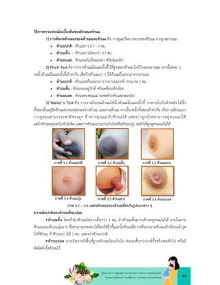 53
คูมือแนวทางการดูแลสุขภาพมารดาและทารกดวยการแพทยแผนไทย
ในระยะกอนตั้งครรภ ระยะตั้งครรภ ระยะคลอด ระยะหลังคลอด
วิธีการตรวจประเมินเบื้องตนของลักษณะหัวนม
1) การสังเกตลักษณะของเตานมและหัวนม คือ การดูแลวัดความยาวของหัวนม จากฐานลานนม
 หัวนมปกติ - หัวนมยาว 0.7 - 1 ซม.
 หัวนมสั้น - หัวนมยาวนอยกวา 0.7 ซม.
 หัวนมบอด - หัวนมจะไมยื่นออกมา หรือบุมลงไป
2) Pinch Test คือ การวางหัวแมมือและนิ้วชี้ไวที่ฐานของหัวนม ใกลกับขอบลานนม จากนั้นคอย ๆ
กดนิ้วหัวแมมือและนิ้วชี้เขาหากัน เพื่อบีบหัวนมเบา ๆ ใหหัวนมยื่นออกมาจากลานนม
 หัวนมปกติ - หัวนมจะยื่นออกมา จากลานนมปกติ ประมาณ 1 ซม.
 หัวนมสั้น - หัวนมจะอยูกับที่ หรือเคลื่อนเล็กนอย
 หัวนมบอด - หัวนมของคุณแม จะหดตัวกลับและจมลงไป
3) Waller’s Test คือ การวางมือบนเตานมใหนิ้วหัวแมมือและนิ้วชี้ วางราบไปกับผิวหนัง ใหนิ้ว
ทั้งสองนั้นอยูชิดหัวนมตรงรอยตอระหวางหัวนม และลานหัวนม จากนั้นกดนิ้วทั้งสองเขาหากัน เปนการเลียนแบบ
การดูดนมตามธรรมชาติของลูก ซึ่งหากคุณแมจับหัวนมได แสดงวาลูกนอยสามารถดูดนมแมได
แตถาหัวนมผลุบลงไปจับไมติด แสดงวาหัวนมแบนราบเกินไปหรือหัวนมบุม จะทำใหลูกดูดนมแมไมได
ความผิดปกติของหัวนมที่พบบอย
หัวนมสั้น โดยทั่วไปหัวนมไมควรสั้นกวา 1 ซม. ถาหัวนมสั้นมากเด็กจะดูดนมไมได ยกเวนลาน
หัวนมและเตานมนุมมาก ซึ่งสามารถทดสอบไดโดยใชนิ้วชี้และนิ้วหัวแมมือวางที่ขอบลานหัวนมเล็กนอยแลวรูด
ไปที่หัวนม ถาหัวนมยาวได 1 ซม. แสดงวาหัวนมปกติ
หัวนมบอด อาจเกิดจากมีพื้นที่ฐานหัวนมนอยเกินไป ทอนมสั้นกวาปกติรั้งหรือหดเขาไป หรือมี
พังผืดดึงรั้งหัวนมไว
ภาพที่ 3.1 หัวนมปกติ ภาพที่ 3.2 หัวนมสั้น ภาพที่ 3.3 หัวนมแบน
ภาพที่ 3.4 หัวนมบุม ภาพที่ 3.5 หัวนมยาว ภาพที่ 3.6 หัวนมบอด
ภาพ 3.1 – 3.6 แสดงลักษณะของหัวนมที่พบในรูปแบบตาง ๆ
 