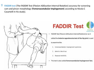  FADDIR test (The FADDIR Test (Flexion ADDuction Internal Rotation) accuracy for screening
cam and pincer morphology (Femoroacetabular Impingement) according to Nicola C
Casartelli in his study).
 
