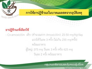 การใช้ยาปฏิชีวนะในบาดแผลสดจากอุบัติเหตุ
ยาปฏิชีวนะที่เลือกใช้
- Co-amoxicillin เด็ก: (ค้านวณจาก Amoxicillin): 25-50 mg/Kg/day
แบ่งให้วันละ 3 ครั้ง (ไม่เกิน 250 mg/ครั้ง)
พร้อมอาหาร
ผู้ใหญ่: 375 mg วันละ 3 ครั้ง หรือ 625 mg
วันละ 2 ครั้ง พร้อมอาหาร
 